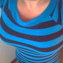 7 Weeks Post Op