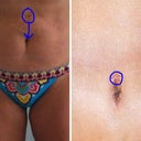 this is my favorite part of my surgery...i really hated that stupid gallbladder scar...it was a little scar but it created a roll there.  the PS yanked it down a good 3-4 inches and stuffed it into my new BB!