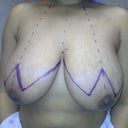 Didn't notice my boobs were different sizes!
