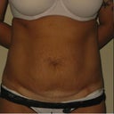before pic