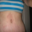 They look killer in a sports bra!  I posted this one for my workout ladies.  I get a splotchy red pattern on my abdomen after my runs but the doc said it's fine.  The blood flow just hasn't re-established all the connections