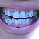 Tray 1