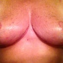 So happy to be 4wks. and 3 days post op.  Everyday things keep getting better and better.