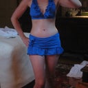 2011 - 9 weeks - less swelling!