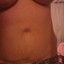 Close up of stomach after 20 lb gain