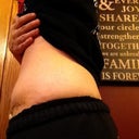 5 days after surgery