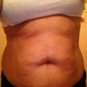 front belly