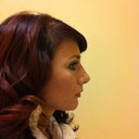 Side view months post op. So happy!