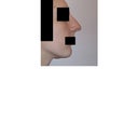 Nose I was born with, before the first rhinoplasty. Glad that thing is gone!