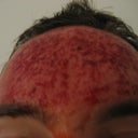 After I got home. The nurse was amazed how much I was bleeding. No pain, no gain, right?