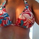 Breast in bathing suit - 2 weeks post op