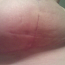 underside 3wks