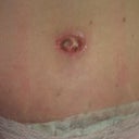 P.O. Day 18 - Belly Button