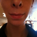 Frontal View