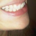 before clear correct side view.