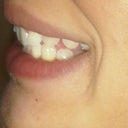 side view on the right side