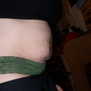 3 weeks before surgery