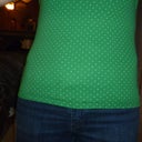 shirt on front view- doesn't look too bad, until you look under my shirt?! 6 days pre op
