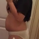 2 days before smart lipo
