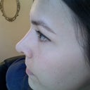 4 weeks, 2 days. Hoping I'm not getting a inverted v deformity.