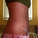 5 weeks... right side