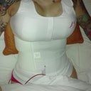 1 day post op
