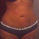 This is like..um 6 months post op, I need to work out more..lol