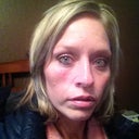 In this picture you can see the scar a little clearer.  The scar itself looks really good!  That was what I was most worried about in the beginning.  However, I'm having a harder time dealing with the indention it's left in the face and the redness.  Both of which should get a little better in time!