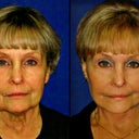 Me before -- and just six weeks after!