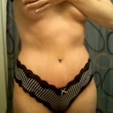 2 weeks post op