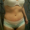 3 weeks post op