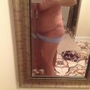 Didn't even get bruising from the lipo