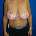 Before reduction