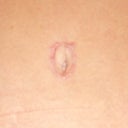 12 weeks belly button