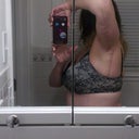 8 Wks - right arm