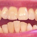 3-29-2012 Tray 2/24