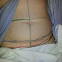 pre operation markings