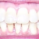 12-19-2012 Mouth closed