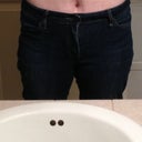 2 weeks - My pre op skinny jeans - no bulges!!!!! weird marks on my skin from CG and I do have a few stretch marks, no big deal :)