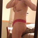 2 weeks - you can see my swelling here and some on my back too.