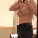 2 weeks - need new skinny jeans, these ones aren't so "skinny" anymore. You can see where they are mishaped from where my skin used to be. Happy with my perky boobs, not too small but a lot smaller than before :)