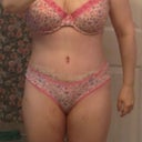 19 days post op. Weight 159