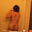 5 days out--Swollen but shape enhancement is VERY evident.
