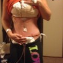 this was the next day after surgery, alot of people say owww but I say wow