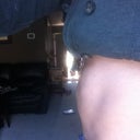 5 months post op