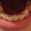 bottom teeth view :) - Tray#8