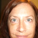 7/15/2012  Bruising worse