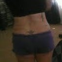 8 weeks po still swollen