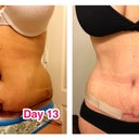 Just another comparison pic.