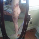 Day 3 post op